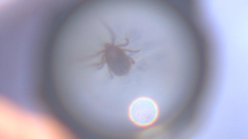 의료 질병 #001-CT_V000000213414.mxf_20220519_150055.042